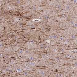 FRA10AC1 Antibody, Novus Biologicals:Antibodies:Primary Antibodies